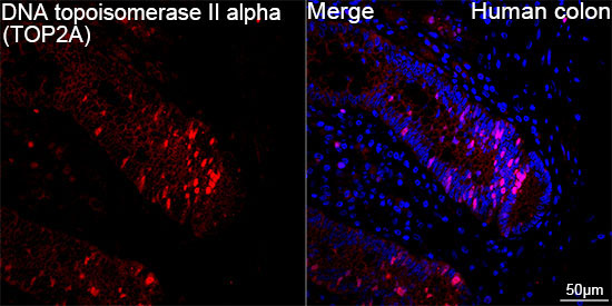 DNA topoisomerase II alpha (TOP2A) Rabbit Monoclonal Antibody - Image 6