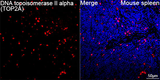 DNA topoisomerase II alpha (TOP2A) Rabbit Monoclonal Antibody - Image 7
