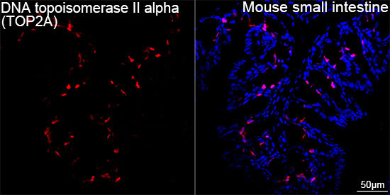 DNA topoisomerase II alpha (TOP2A) Rabbit Monoclonal Antibody - Image 8