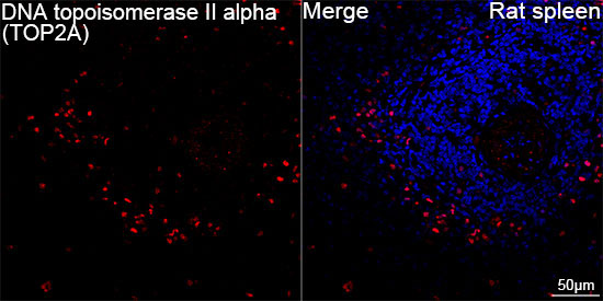 DNA topoisomerase II alpha (TOP2A) Rabbit Monoclonal Antibody - Image 9