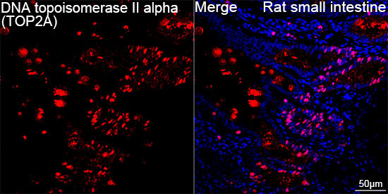 DNA topoisomerase II alpha (TOP2A) Rabbit Monoclonal Antibody - Image 10