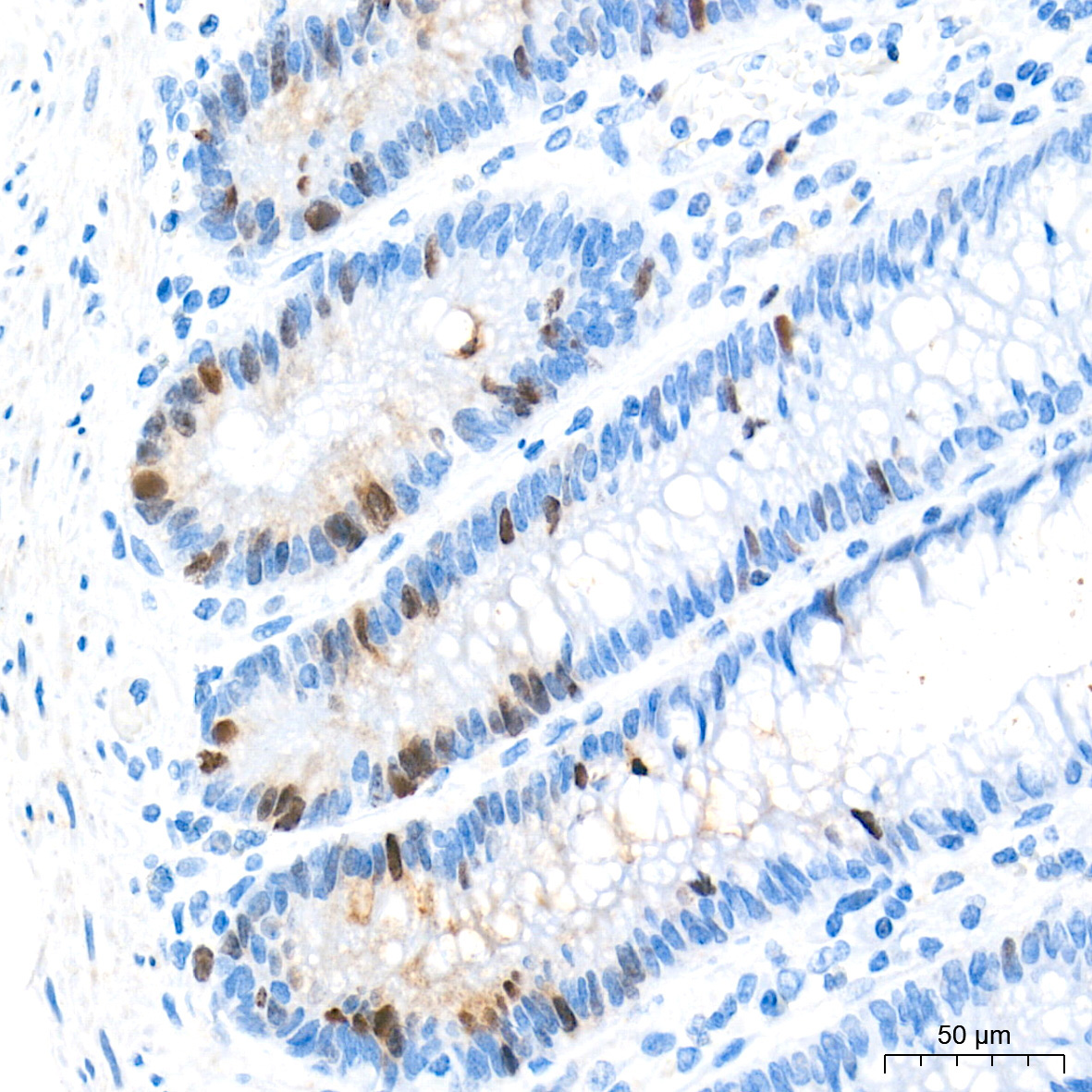 DNA topoisomerase II alpha (TOP2A) Rabbit Monoclonal Antibody - Image 11