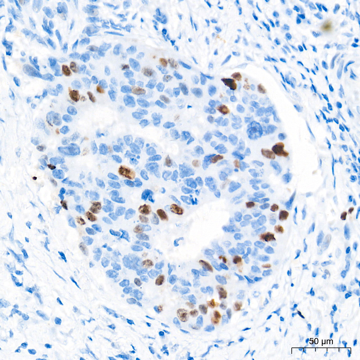 DNA topoisomerase II alpha (TOP2A) Rabbit Monoclonal Antibody - Image 12