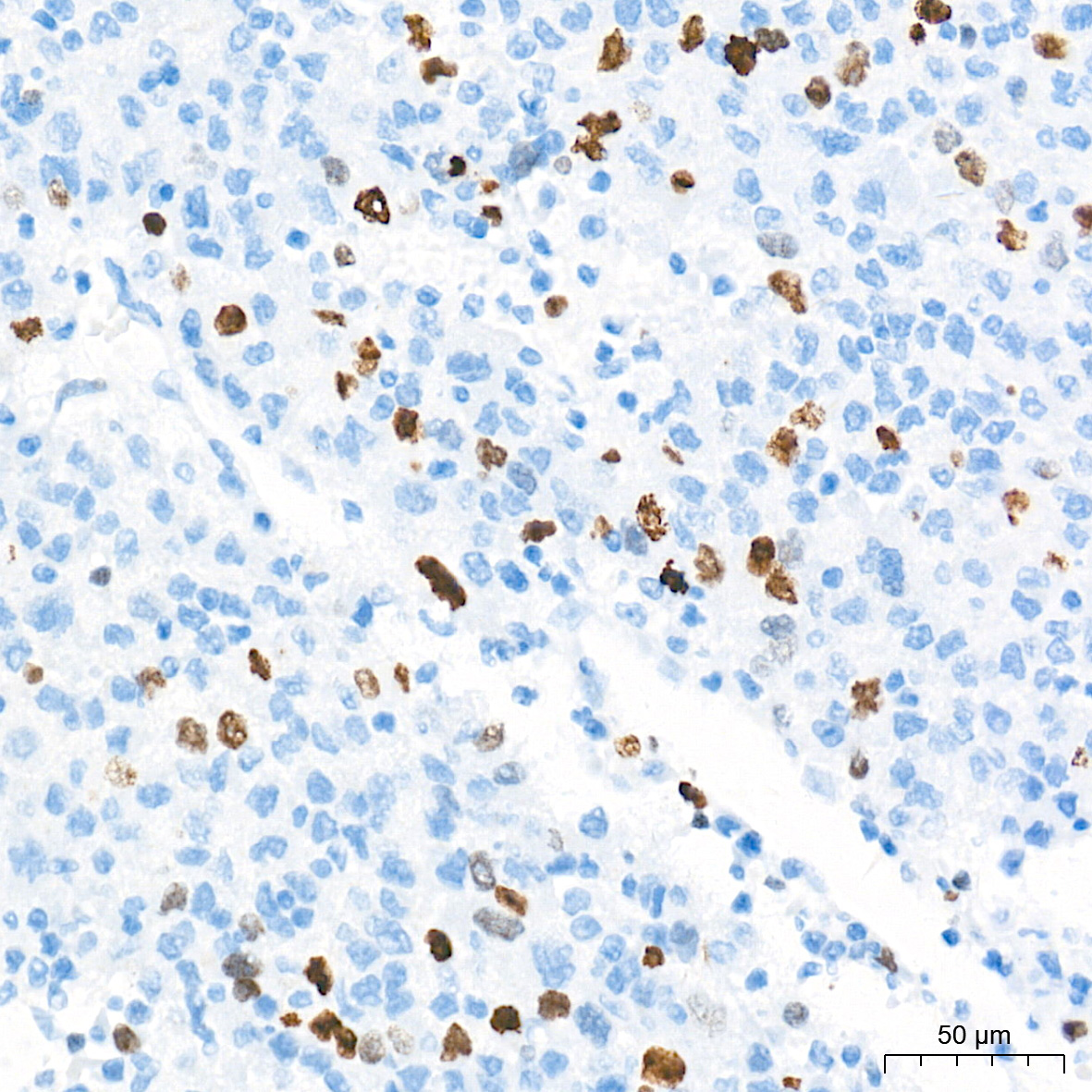 DNA topoisomerase II alpha (TOP2A) Rabbit Monoclonal Antibody - Image 13