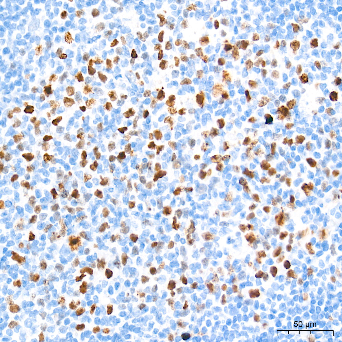 DNA topoisomerase II alpha (TOP2A) Rabbit Monoclonal Antibody - Image 14