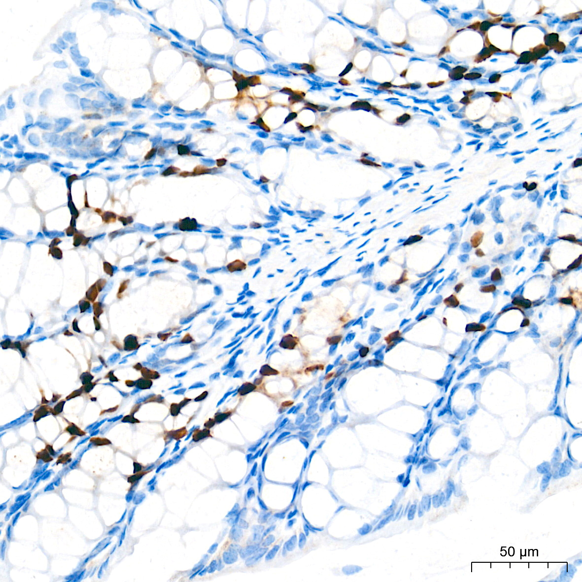 DNA topoisomerase II alpha (TOP2A) Rabbit Monoclonal Antibody - Image 15