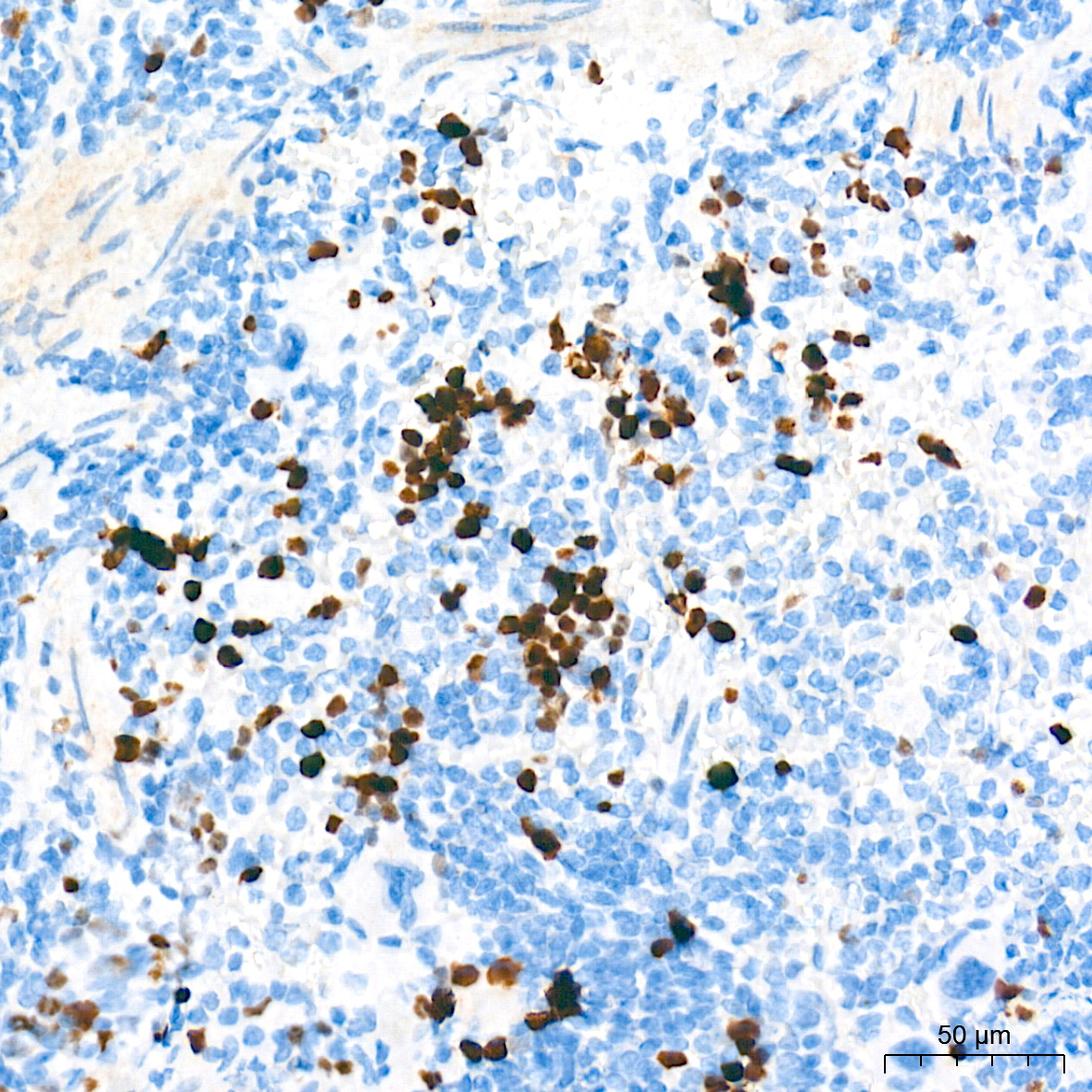 DNA topoisomerase II alpha (TOP2A) Rabbit Monoclonal Antibody - Image 16