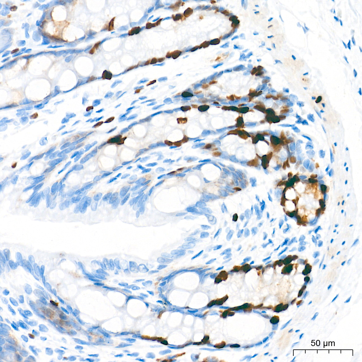DNA topoisomerase II alpha (TOP2A) Rabbit Monoclonal Antibody - Image 17