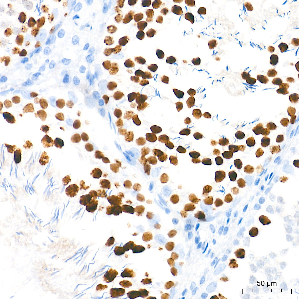 DNA topoisomerase II alpha (TOP2A) Rabbit Monoclonal Antibody - Image 18