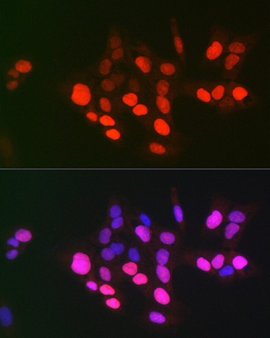 DNA topoisomerase II alpha (TOP2A) Rabbit Polyclonal Antibody