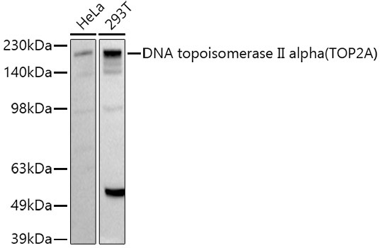 DNA topoisomerase II alpha (TOP2A) Rabbit Polyclonal Antibody