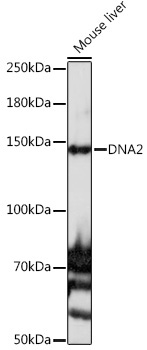 DNA2 Rabbit Polyclonal Antibody