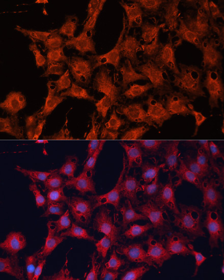 DNAJA2 Rabbit Polyclonal Antibody - Image 2