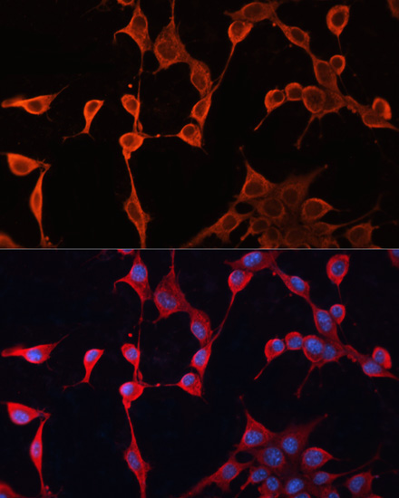 DNAJA2 Rabbit Polyclonal Antibody - Image 3