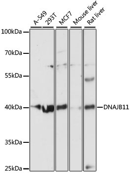 DNAJB11 Rabbit Polyclonal Antibody