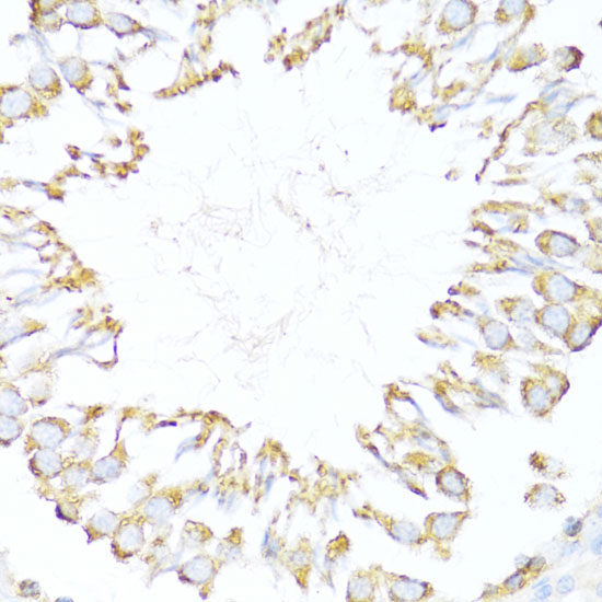 DNAJB11 Rabbit Polyclonal Antibody - Image 2