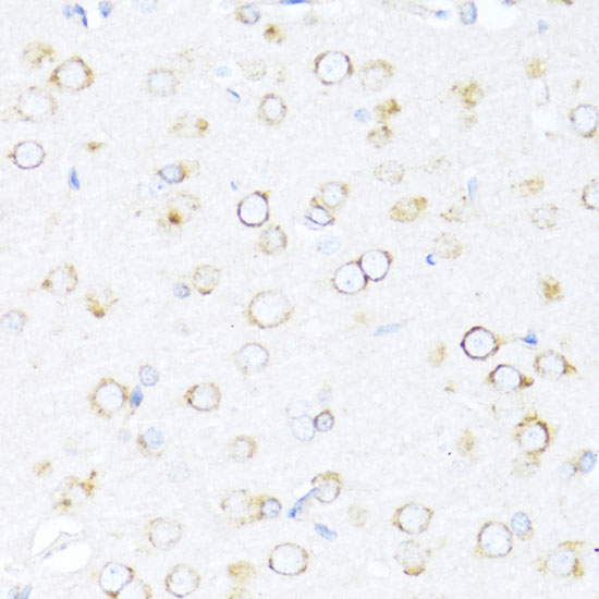 DNAJB11 Rabbit Polyclonal Antibody - Image 3