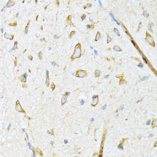 DNAJB11 Rabbit Polyclonal Antibody - Image 4