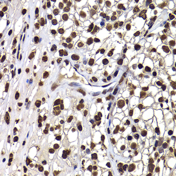 DNAJB6 Rabbit Polyclonal Antibody - Image 2