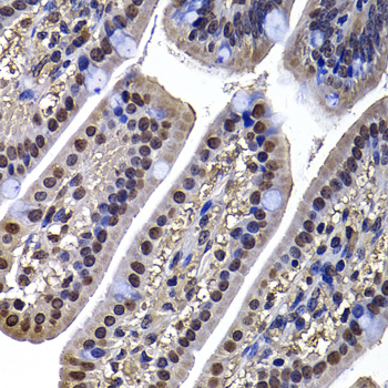 DNAJB6 Rabbit Polyclonal Antibody - Image 3