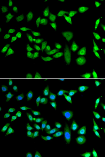 DNAJB6 Rabbit Polyclonal Antibody - Image 4