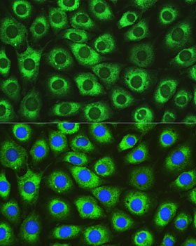 DNAJC10 Rabbit Polyclonal Antibody - Image 2