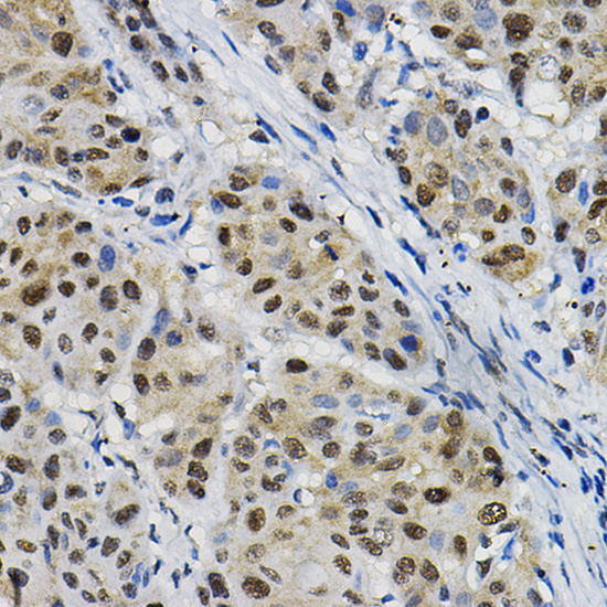 DNAJC17 Rabbit Polyclonal Antibody - Image 3