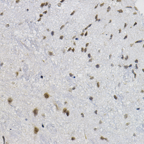 DNAJC17 Rabbit Polyclonal Antibody - Image 4