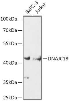 DNAJC18 Rabbit Polyclonal Antibody
