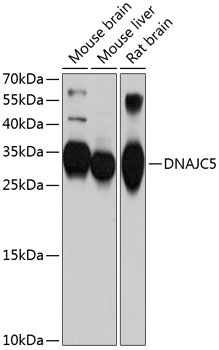 DNAJC5 Rabbit Polyclonal Antibody