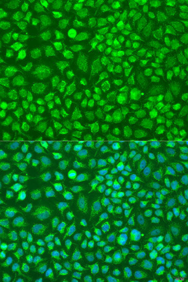 DNAL1 Rabbit Polyclonal Antibody - Image 2
