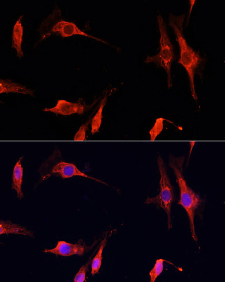 DNASE1 Rabbit Polyclonal Antibody