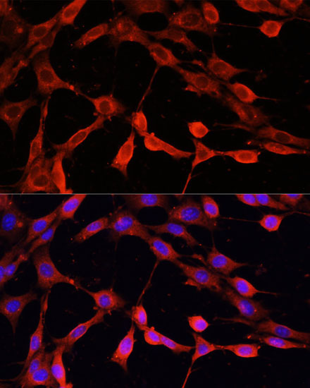 DNASE1 Rabbit Polyclonal Antibody - Image 2