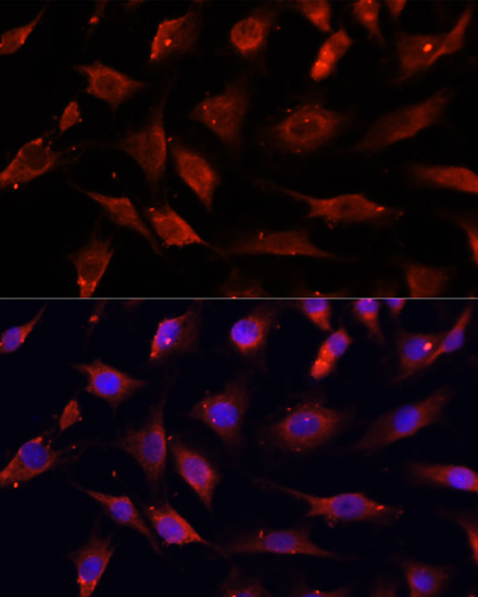 DNASE1L1 Rabbit Polyclonal Antibody - Image 2