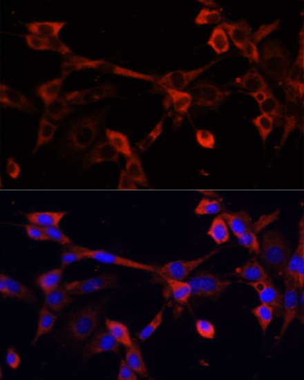 DNASE1L1 Rabbit Polyclonal Antibody - Image 3