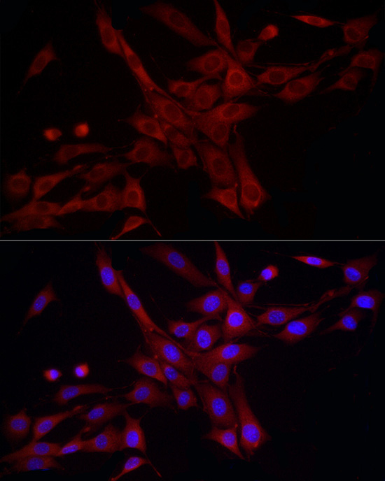 DNM1L Rabbit Polyclonal Antibody
