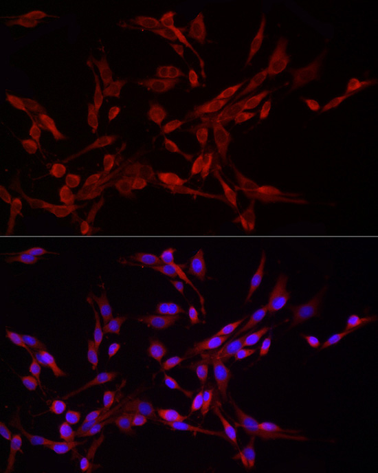 DNM1L Rabbit Polyclonal Antibody - Image 2