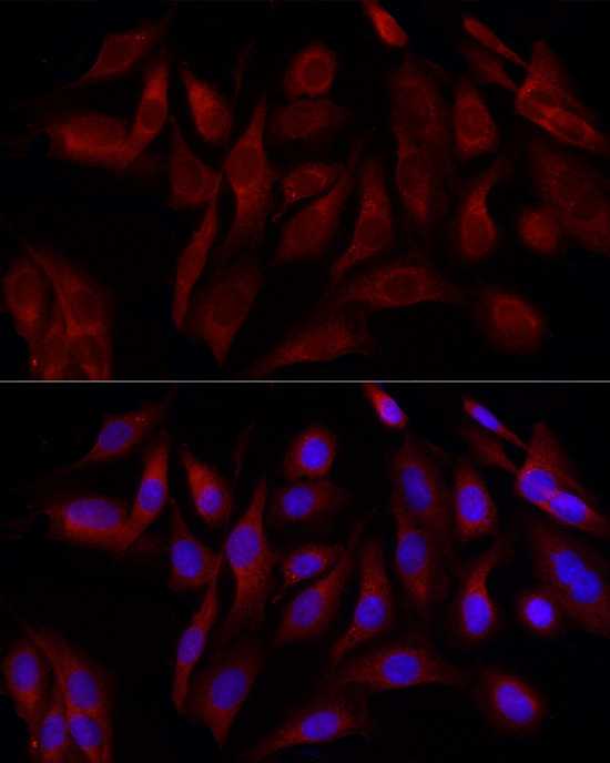 DNM1L Rabbit Polyclonal Antibody - Image 3