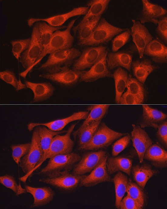 DNM2 Rabbit Polyclonal Antibody