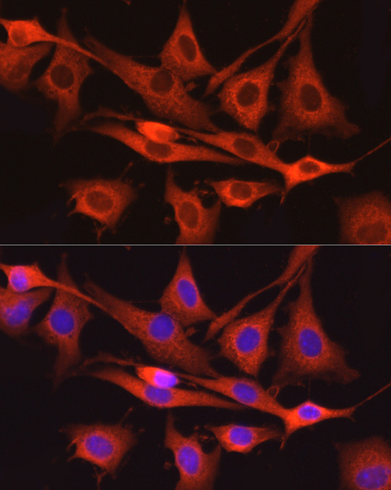 DNM2 Rabbit Polyclonal Antibody - Image 2