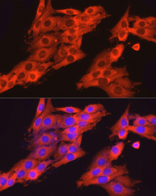 DNM2 Rabbit Polyclonal Antibody - Image 3