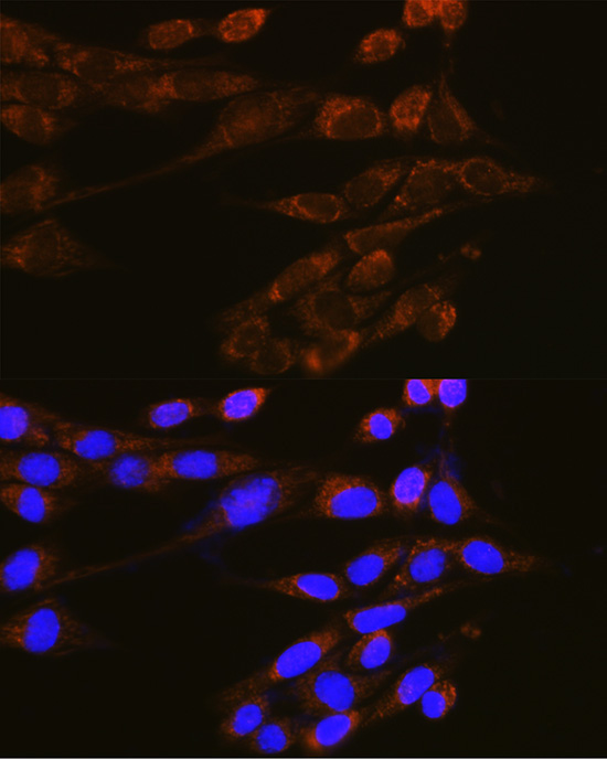 DNM2 Rabbit Polyclonal Antibody - Image 2