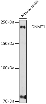 DNMT1 Rabbit Polyclonal Antibody - Image 2