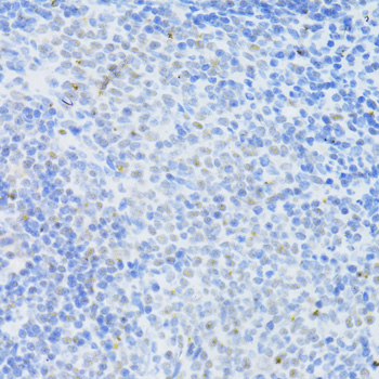 DNMT1 Rabbit Polyclonal Antibody - Image 3