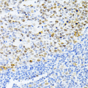 DNMT1 Rabbit Polyclonal Antibody - Image 4