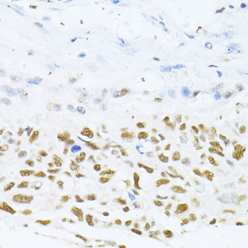 DNMT1 Rabbit Polyclonal Antibody - Image 5