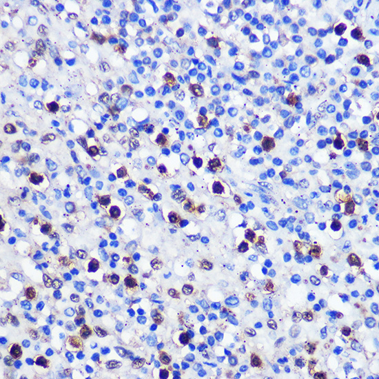 DNMT1 Rabbit Polyclonal Antibody - Image 2