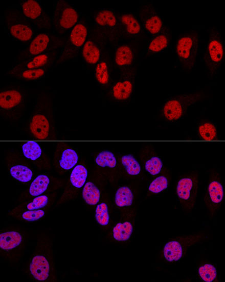 DNMT1 Rabbit Polyclonal Antibody - Image 3