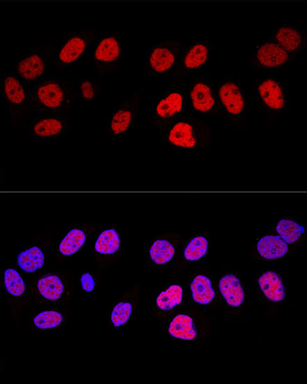 DNMT1 Rabbit Polyclonal Antibody - Image 4