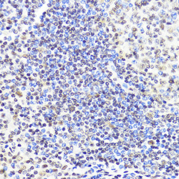DNMT1 Rabbit Polyclonal Antibody - Image 2